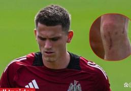 竞彩世界杯-博特曼回归阵容，但埃迪·豪的谨慎比庆祝更重要